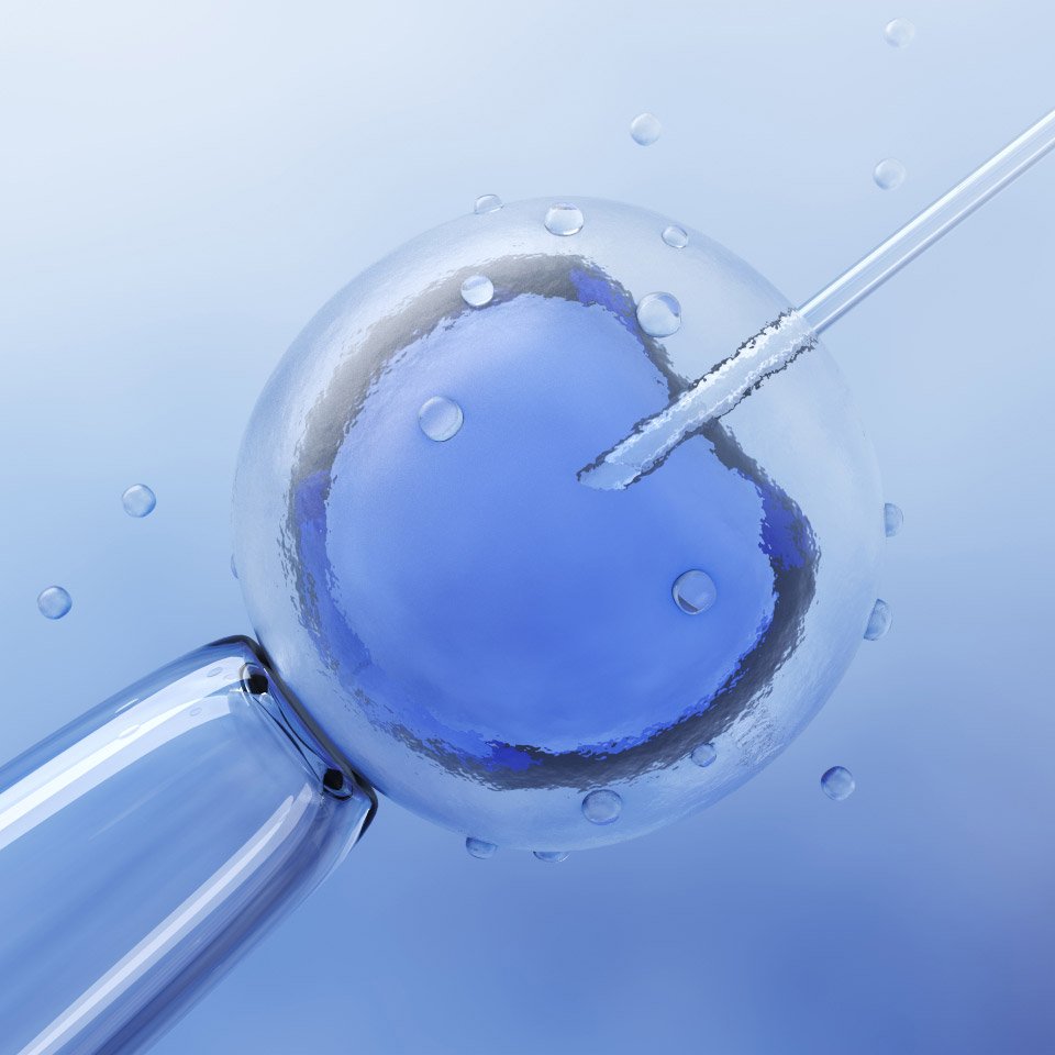 IVF