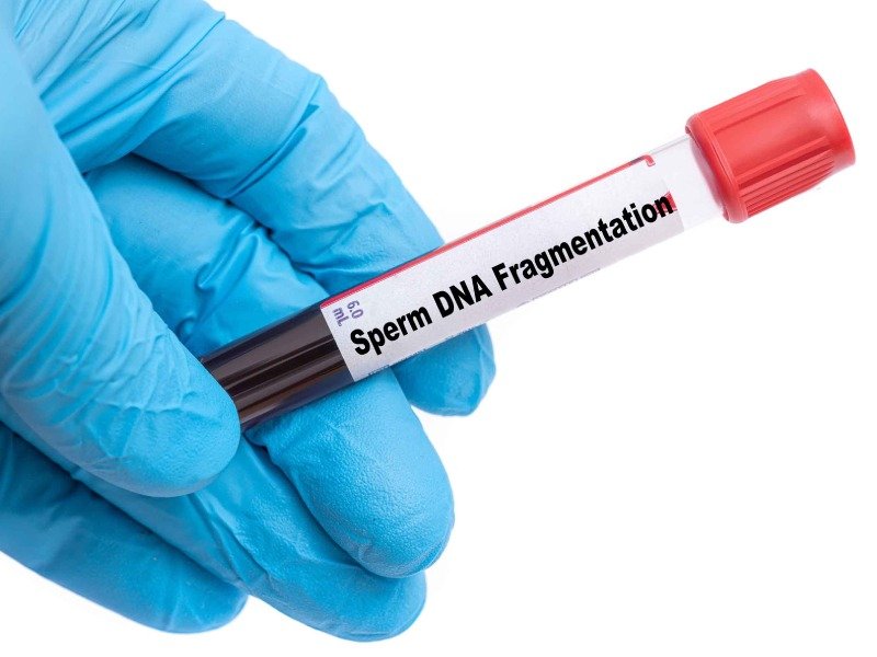 Sperm DNA Index